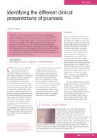 Identifying the different clinical presentations of psoriasis